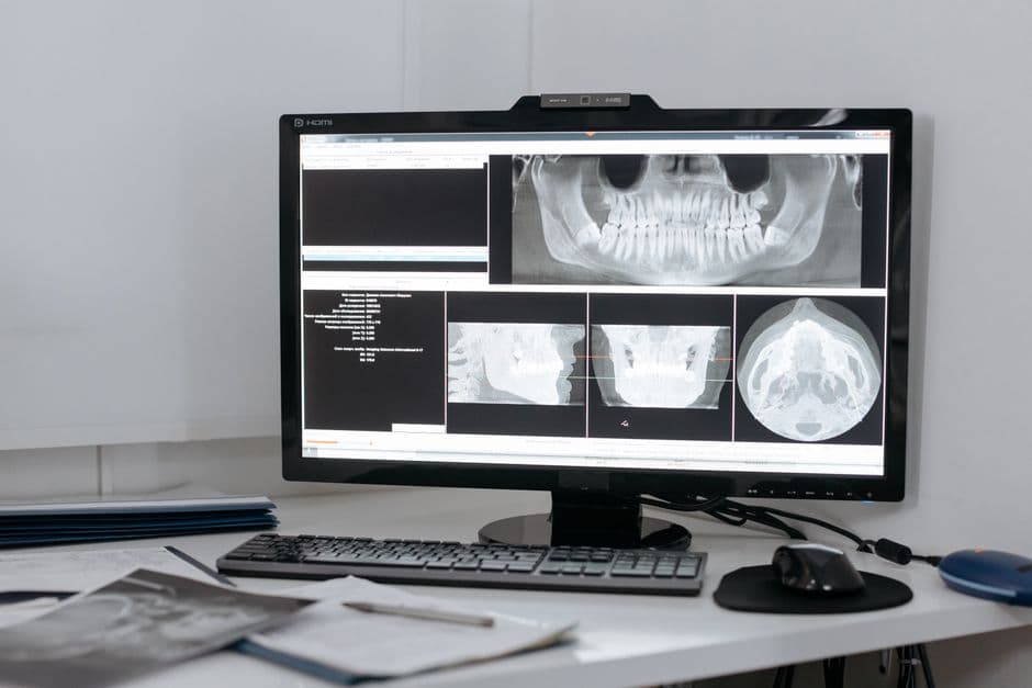 🦷 Diagnostic dentaire ⚡ limites des outils numériques